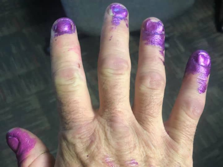 2-year-old paints firefighter's nails after car crash