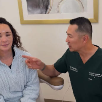 Facelift at 50