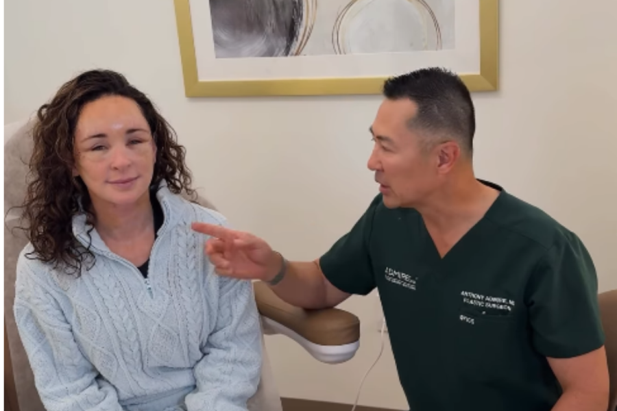 Facelift at 50